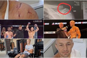 Legendinis MMA kovotojas S. Grečicho po traumos sugrįš dar stipresnis